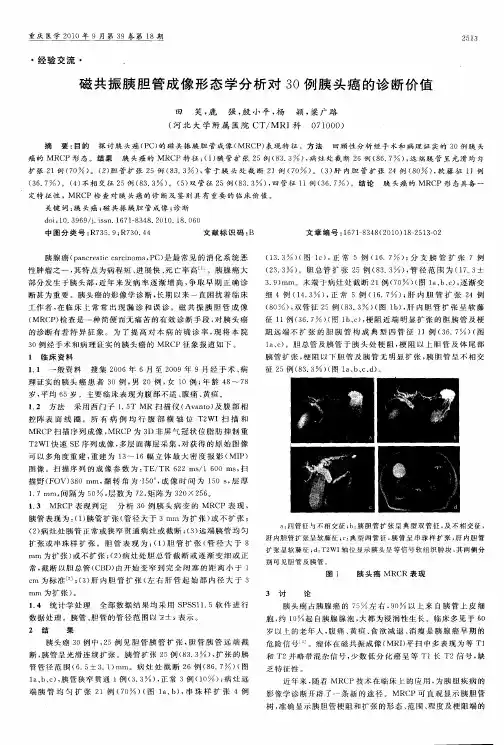 磁共振胰胆管成像形态学分析对30例胰头癌的诊断价值