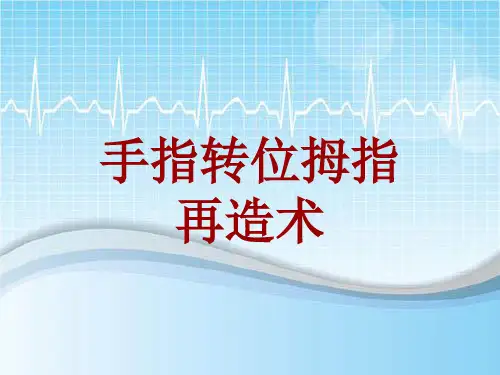手术讲解模板：手指转位拇指再造术