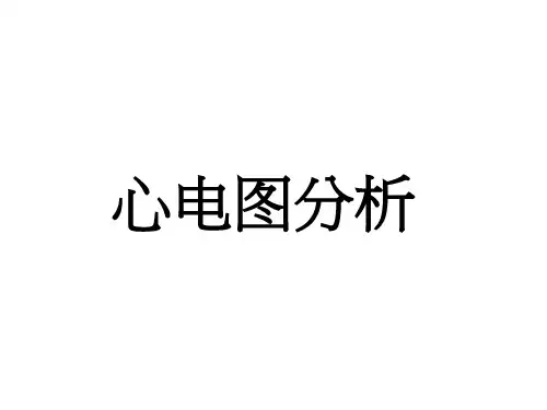 常见心电图分析