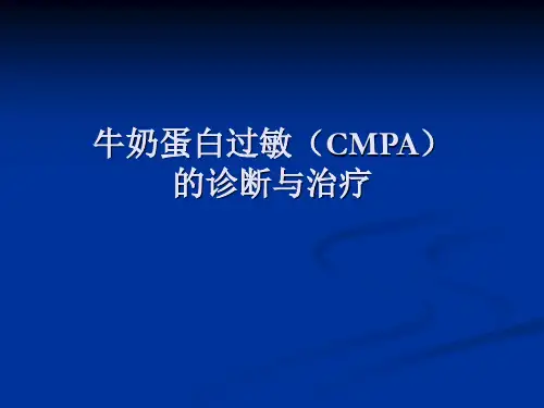 牛奶蛋白过敏诊治讲解