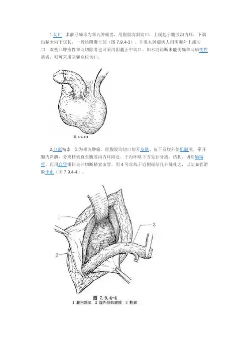 睾丸肿瘤切除术