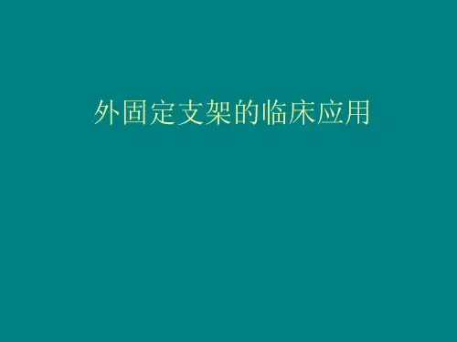外固定支架的临床应用