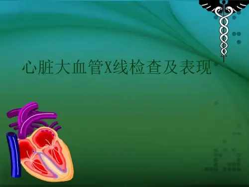 心脏大血管X线表现