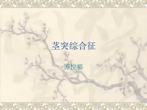 茎突综合征