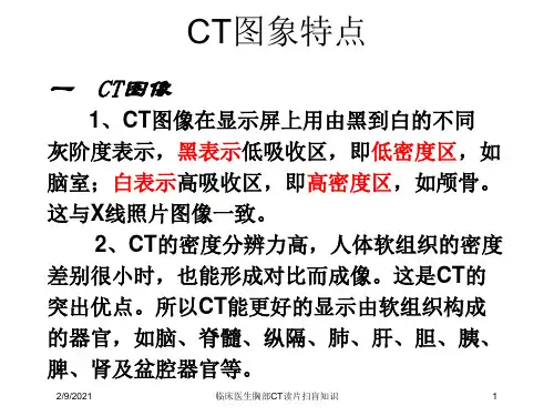 临床医生胸部CT读片扫盲知识课件