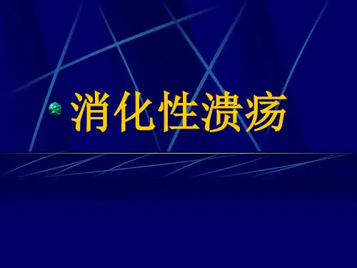 消化性溃疡资料PPT课件