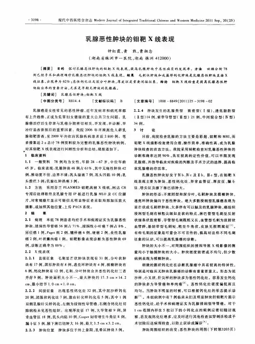 乳腺恶性肿块的钼靶X线表现
