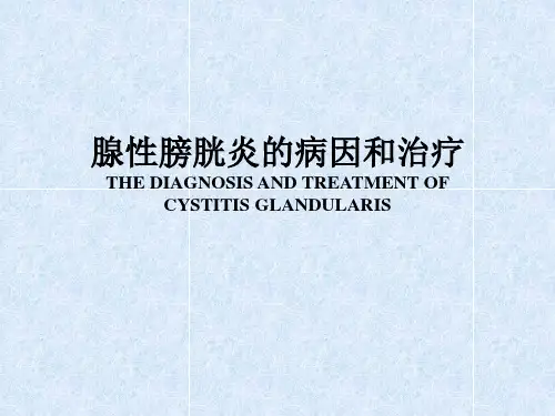 腺性膀胱炎