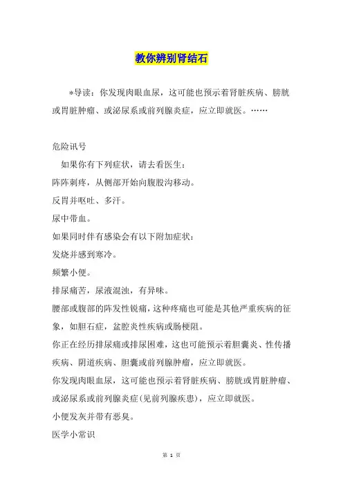 教你辨别肾结石