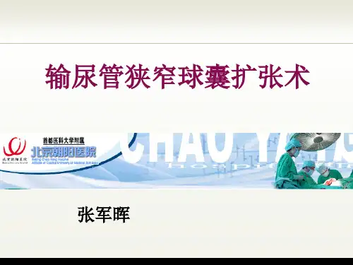 球囊扩张张军晖 ppt课件