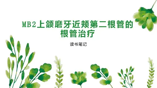 MB2上颌磨牙近颊第二根管的根管治疗