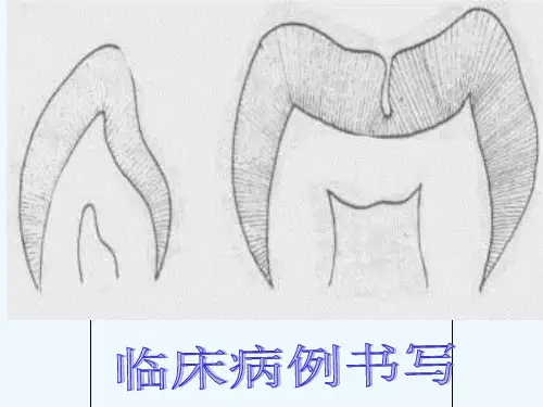 第四章龋病治疗
