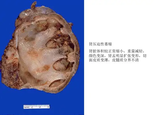 病理实验(图文并茂)X考试图片