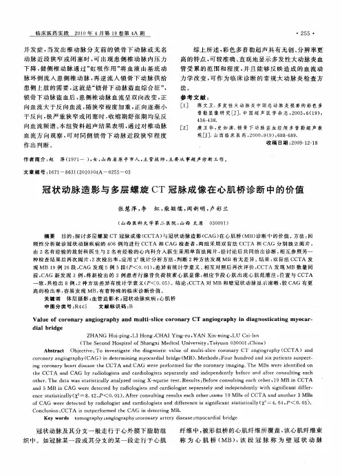 冠状动脉造影与多层螺旋CT冠脉成像在心肌桥诊断中的价值