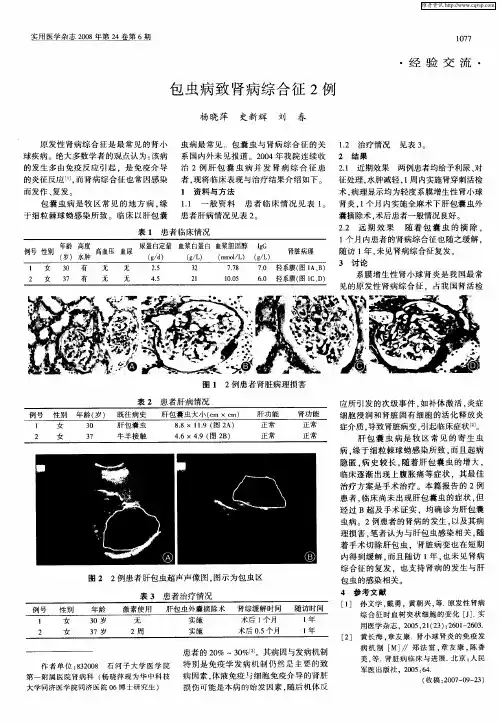 包虫病致肾病综合征2例