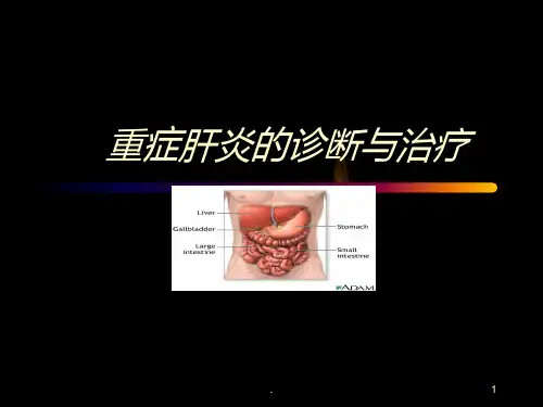 重症肝炎的诊断 PPT课件