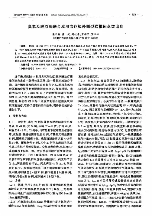 臭氧及胶原酶联合应用治疗极外侧型腰椎间盘突出症