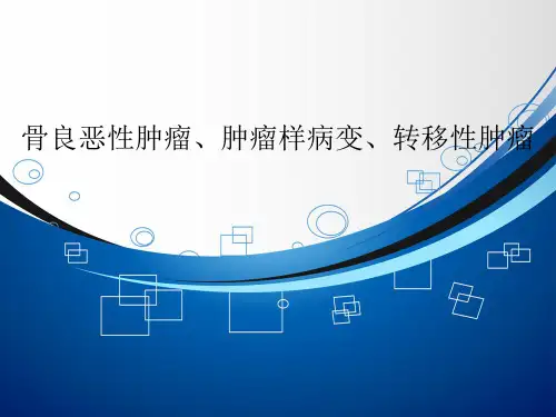 骨肿瘤影像诊断