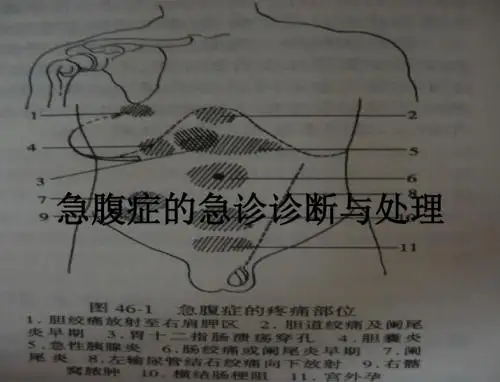 急腹症的急诊诊断与处理ppt课件