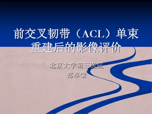 前交叉韧带(ACL)重建后：影像