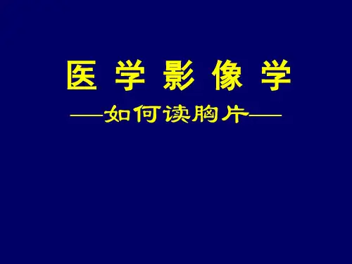 如何读胸片