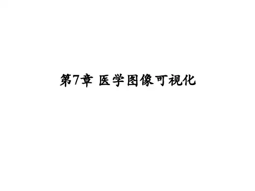 第7章医学图像可视化