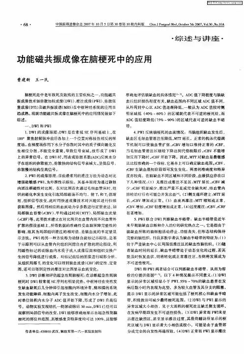功能磁共振成像在脑梗死中的应用