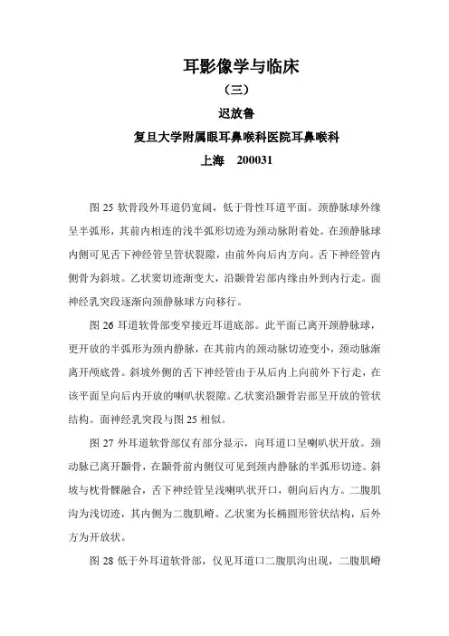 颞骨CT图解讲座3