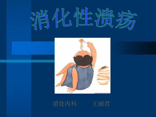 消化性溃疡