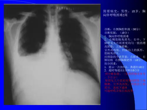 X线读片考试