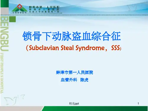 锁骨下动脉盗血综合征详解