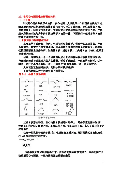另类心电图学讲义3--P波方向来源分析