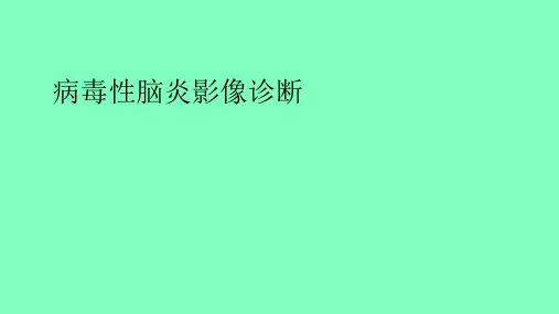 病毒性脑炎的影像诊断