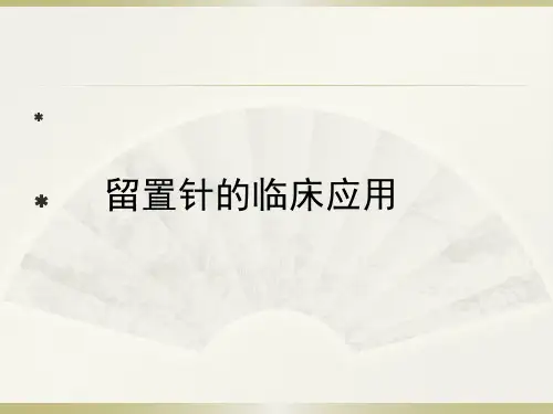 留置针的临床应用