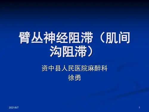 徐氏改良臂丛(肌间沟)阻滞麻醉