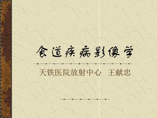 CT学习——食道病变