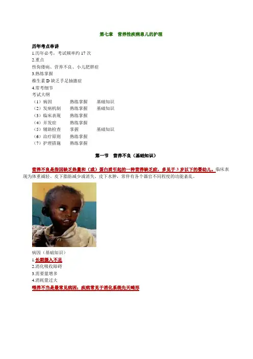 主管护师儿科讲解——第七章营养性疾病患儿护理