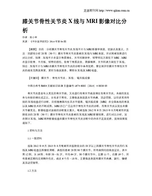 膝关节骨性关节炎X线与MRI影像对比分析
