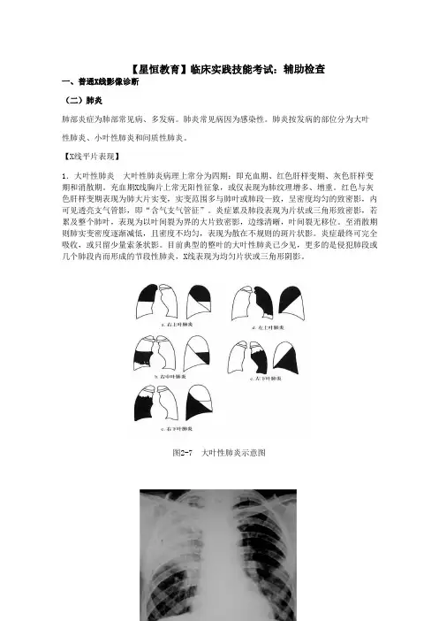 实践技能辅助检查之普通X线影像诊断(二)肺炎[临床实践技能考试]