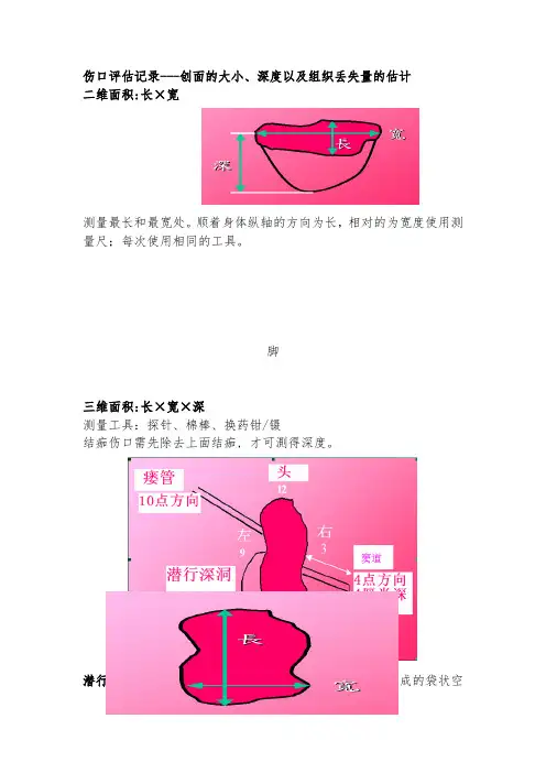压力性损伤伤口评估