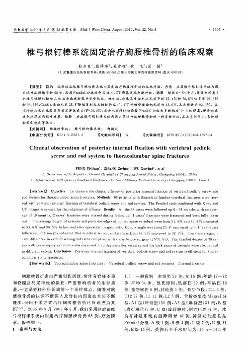 椎弓根钉棒系统固定治疗胸腰椎骨折的临床观察