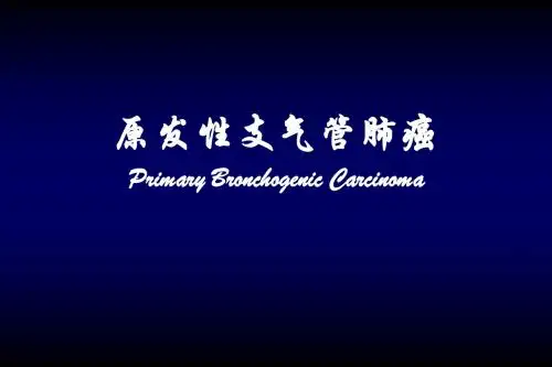 肺癌
