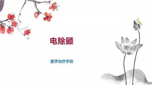 电除颤