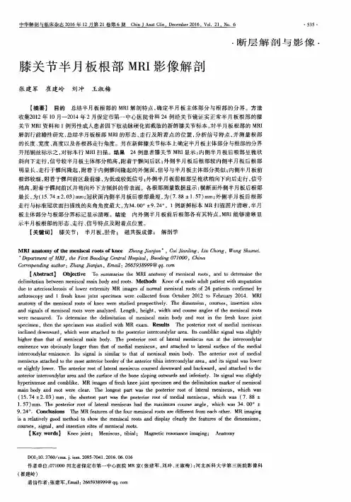 膝关节半月板根部MRI影像解剖