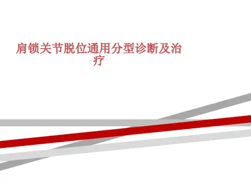 肩锁关节脱位通用分型诊断及治疗