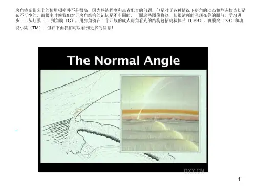 房角镜检查(课堂PPT)