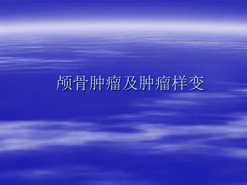 颅骨肿瘤及肿瘤样变ppt课件
