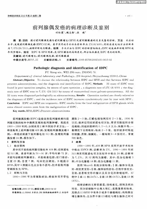 前列腺偶发癌的病理诊断与鉴别