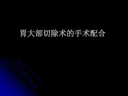 胃大部切除术