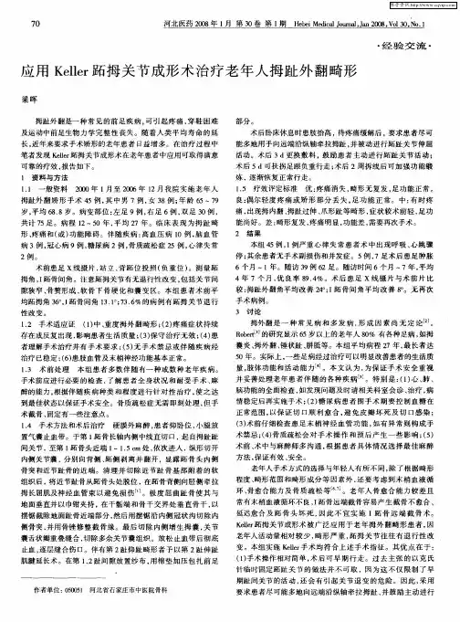 应用Keller跖拇关节成形术治疗老年人拇趾外翻畸形